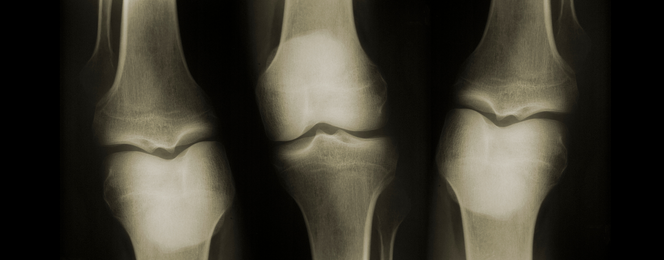 x-ray