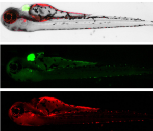 amino-terminal fragment of ApoE4