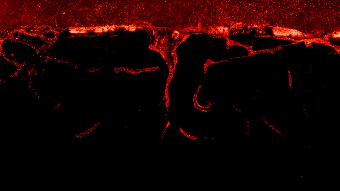 Biological Drivers