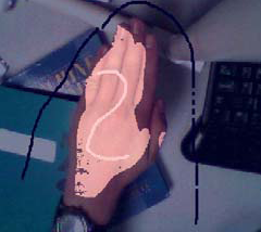 photo of a hand