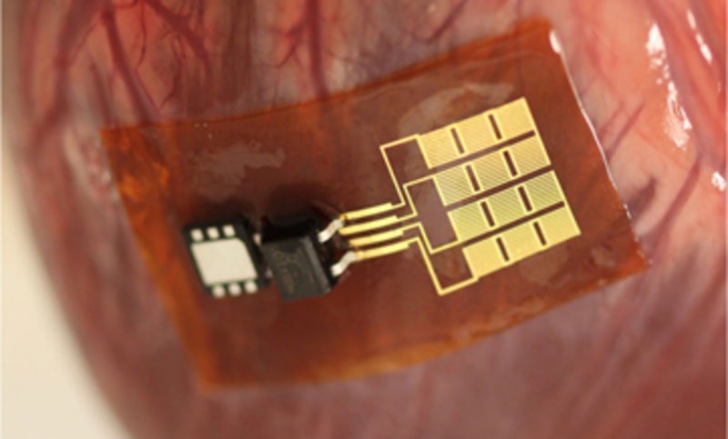 circuitry