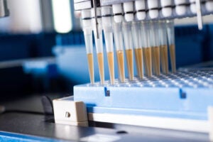 Test tubes hold yellow liquid in a lab.